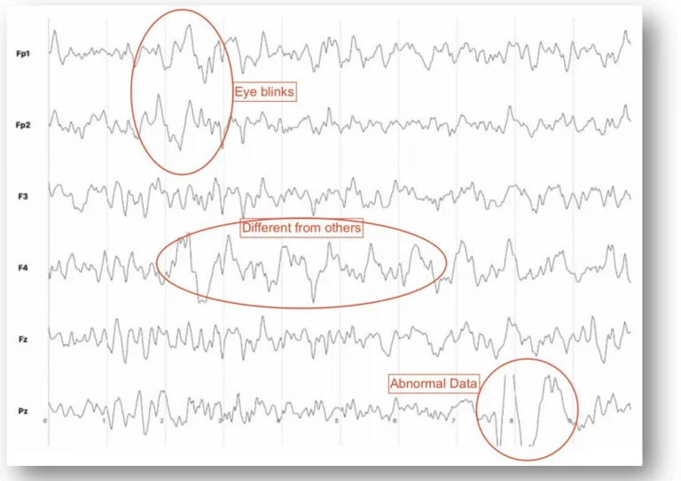 Brainwaves